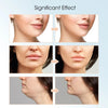 Facial Lifting - ITurn Heads