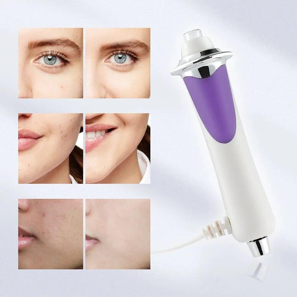 Radio Frequency Face Lifting Wand - ITurn Heads